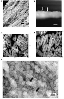 Crystal Initiation Structures in Developing Enamel: Possible Implications for Caries Dissolution of Enamel Crystals